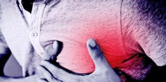 Помощь при сердечном приступе