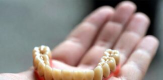 Все, что надо знать о протезировании зубов