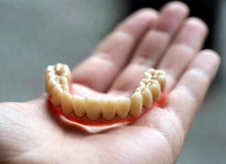 Все, что надо знать о протезировании зубов